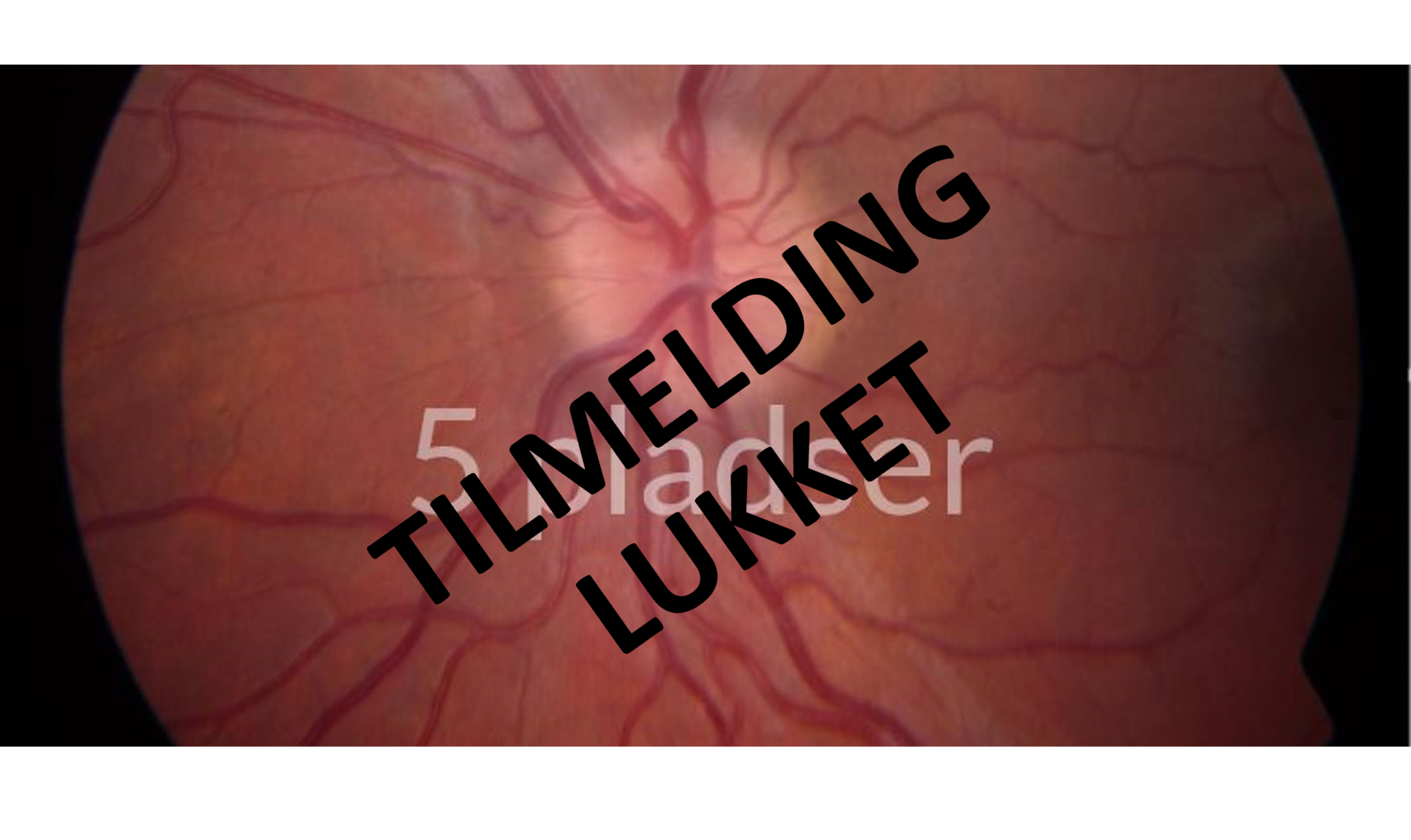 A-KURSUS I NEUROOFTALMOLOGI 4.-8. SEPTEMBER – Plads til 5 uddannelseslæger N/NF/NK