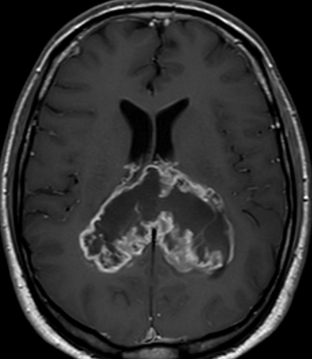 INTERNAT 2024 – Lukket for tilmeldinger