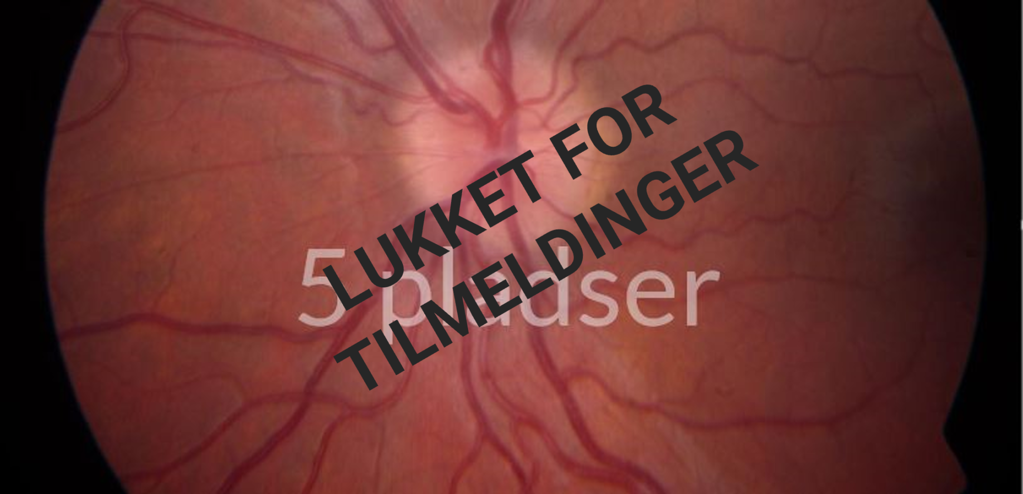 A-KURSUS I NEUROOFTALMOLOGI 2.-6. SEPTEMBER – Plads til 5 kommende N/NF/NK læger